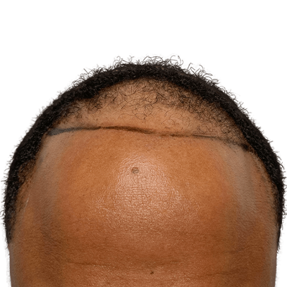 B-3