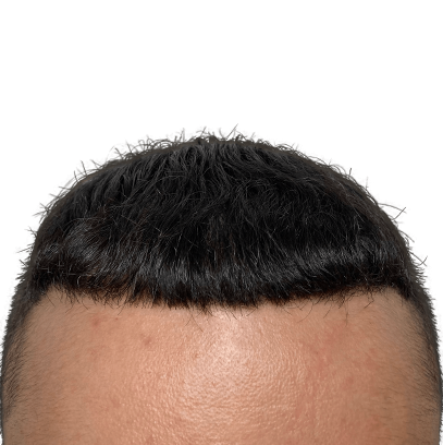 a-4