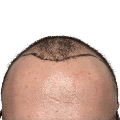 b-4